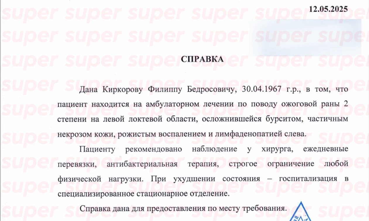Фото: Super