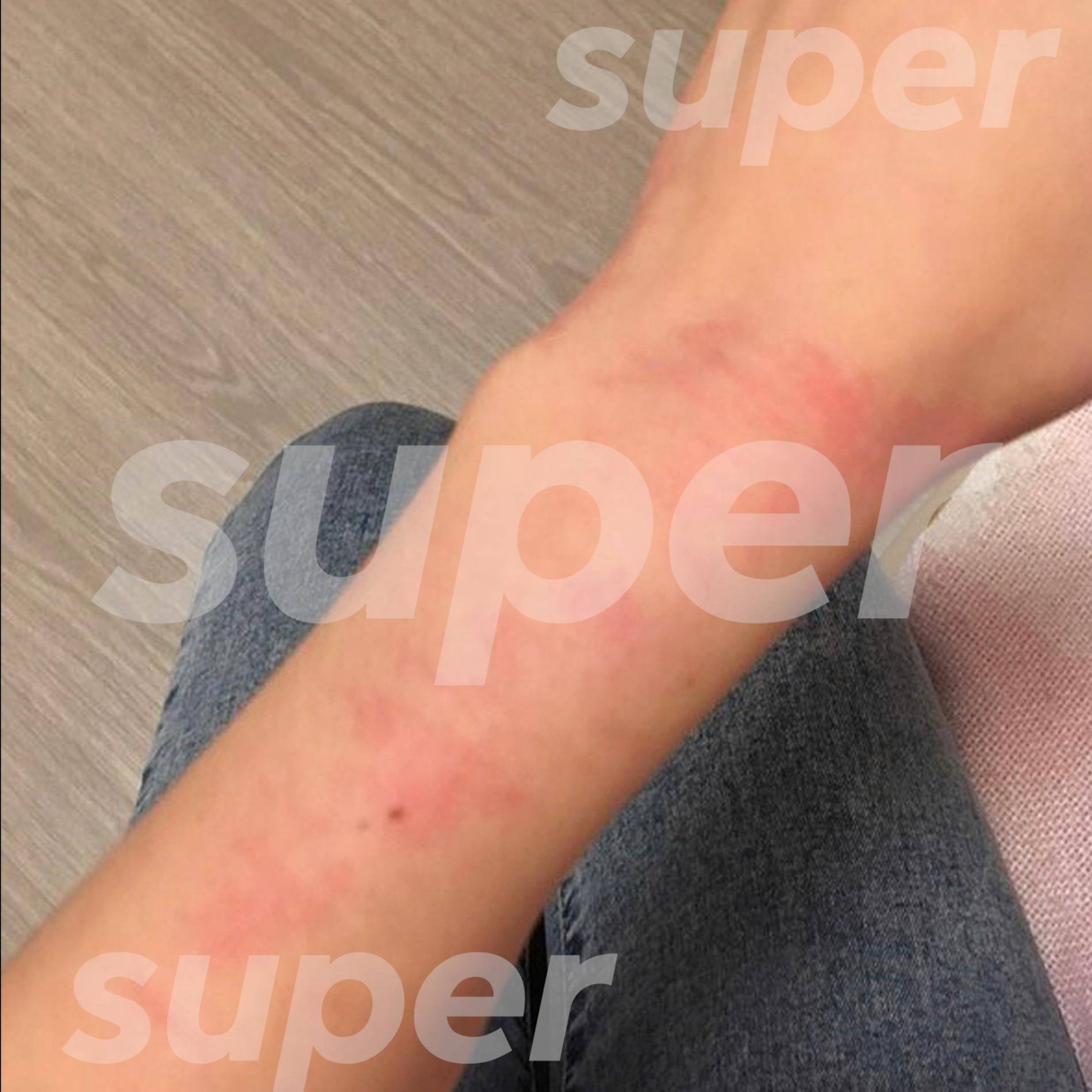 Фото: Super
