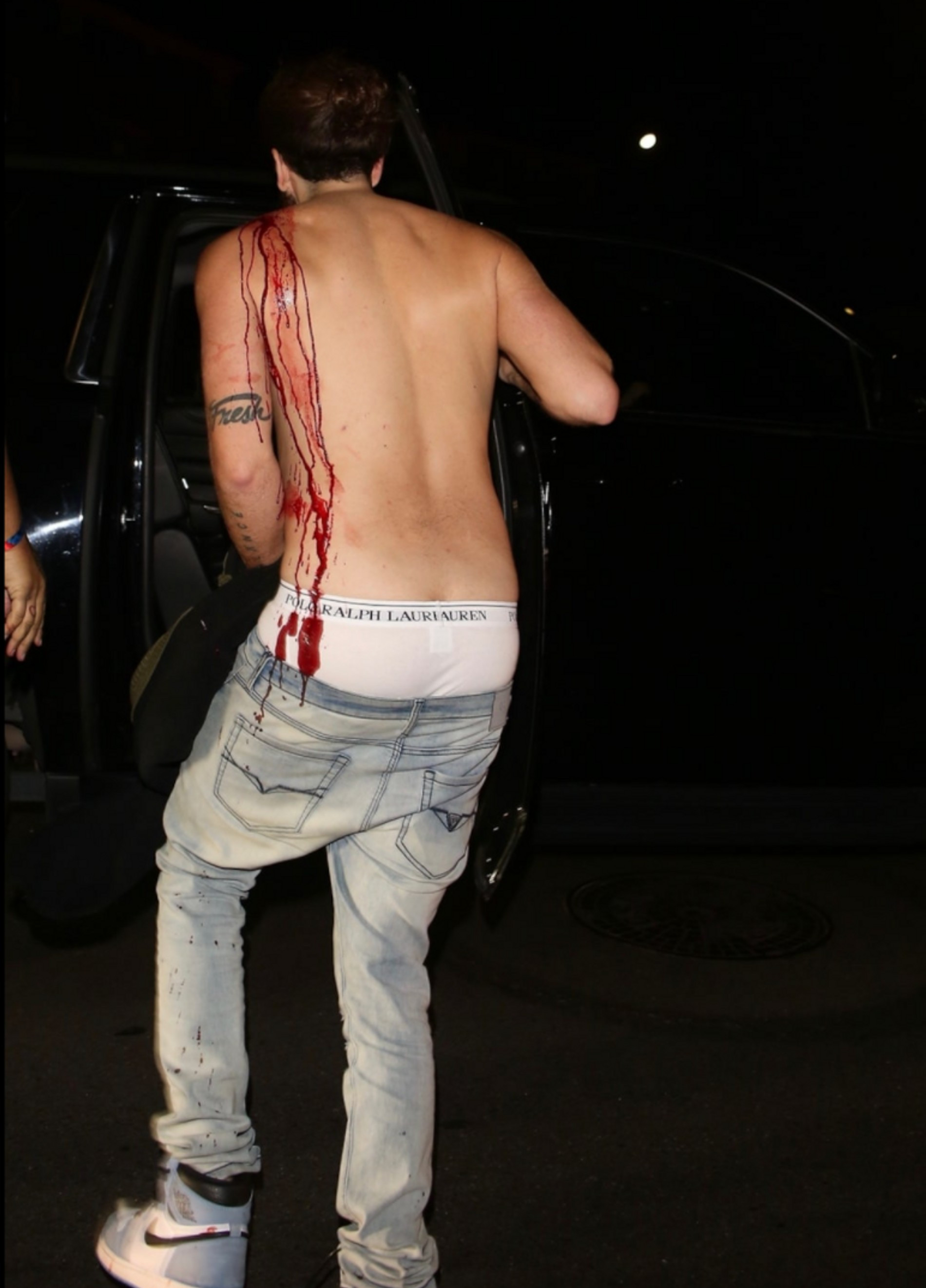 TMZ