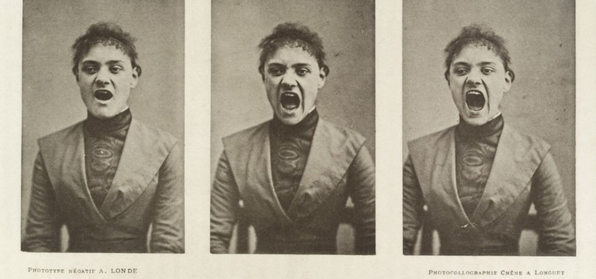 Источник: Wellcome Collection