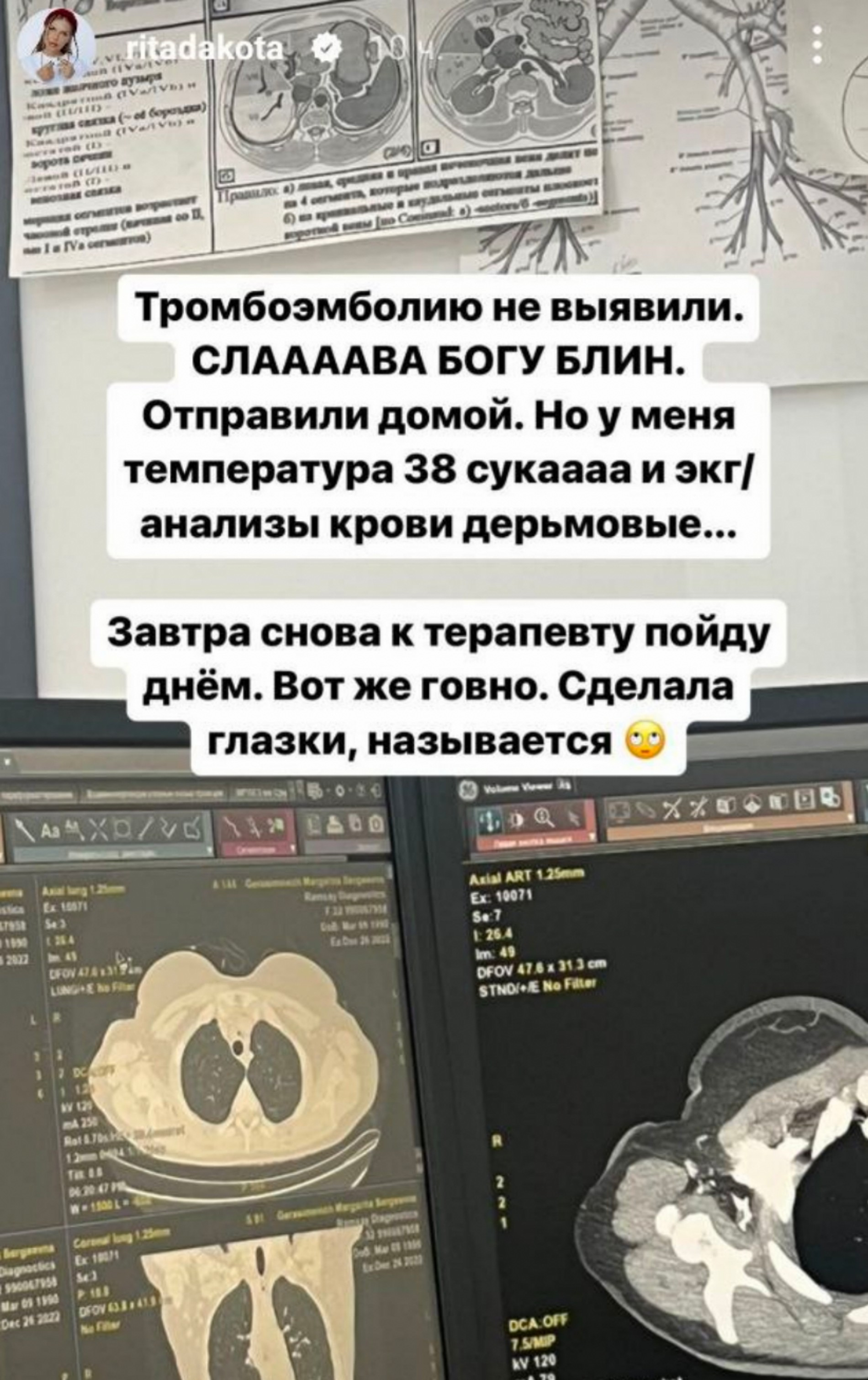 Фото: Инстаграм (запрещен в РФ) Риты Дакоты