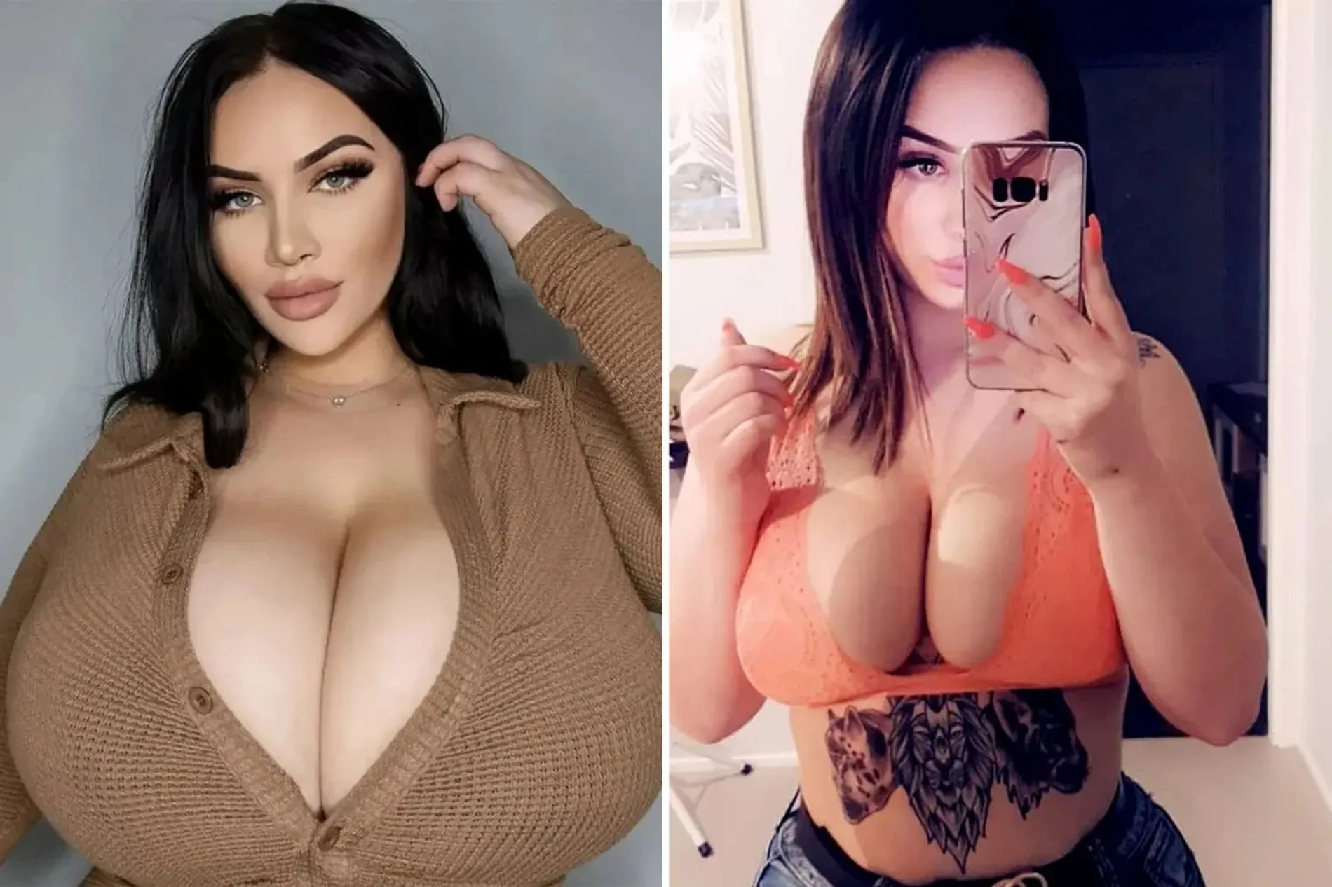 У 27-летней Памелии редкое заболевание — гигантомастия
Фото: NY Post