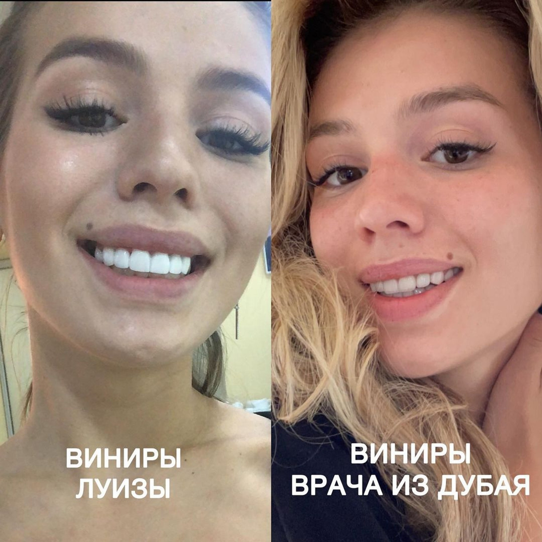 Фото: Инстаграм (запрещен в РФ) / @lusia_chebotina