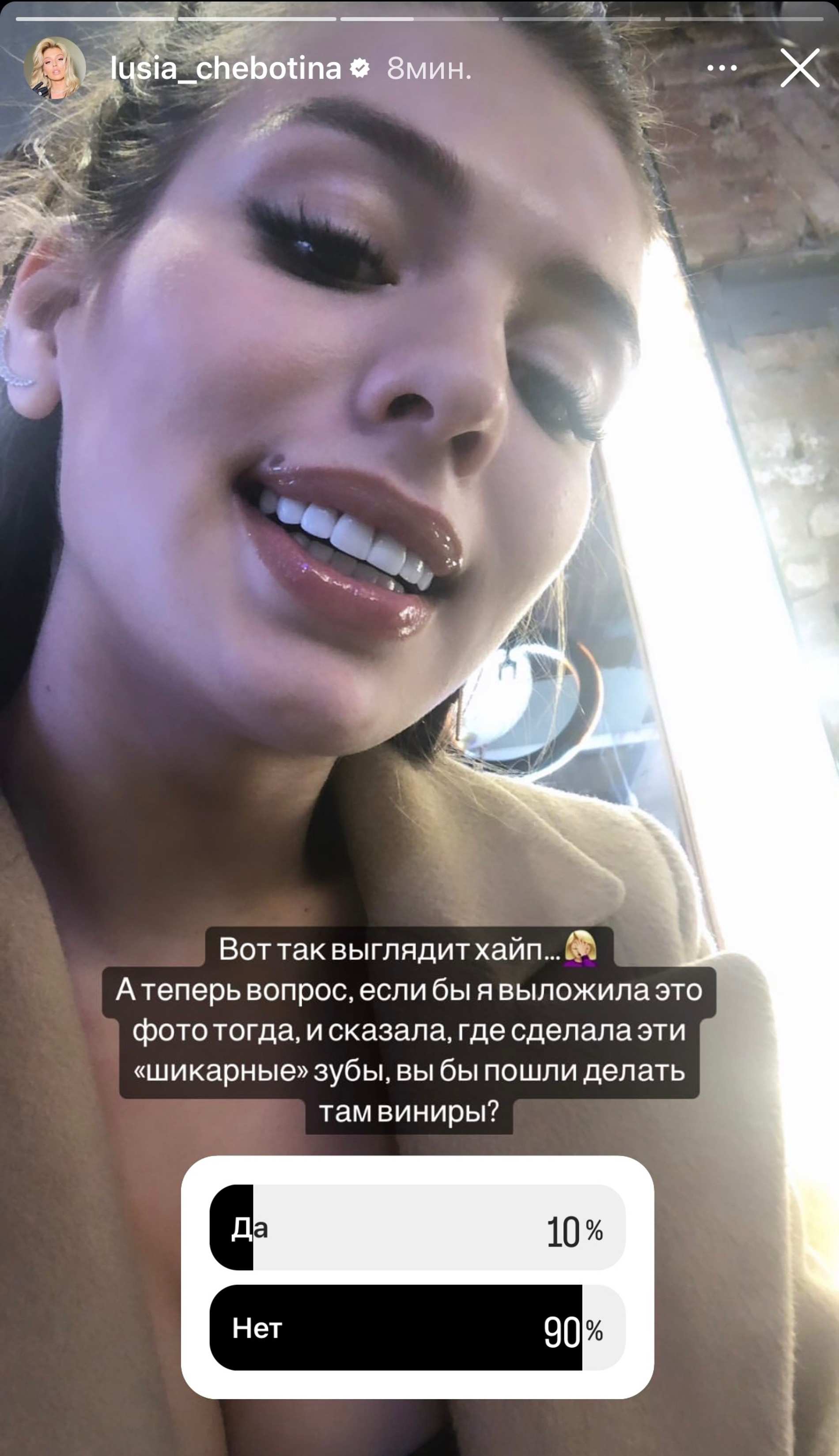 Люся Чеботина показывает зубы от доктора Луизы