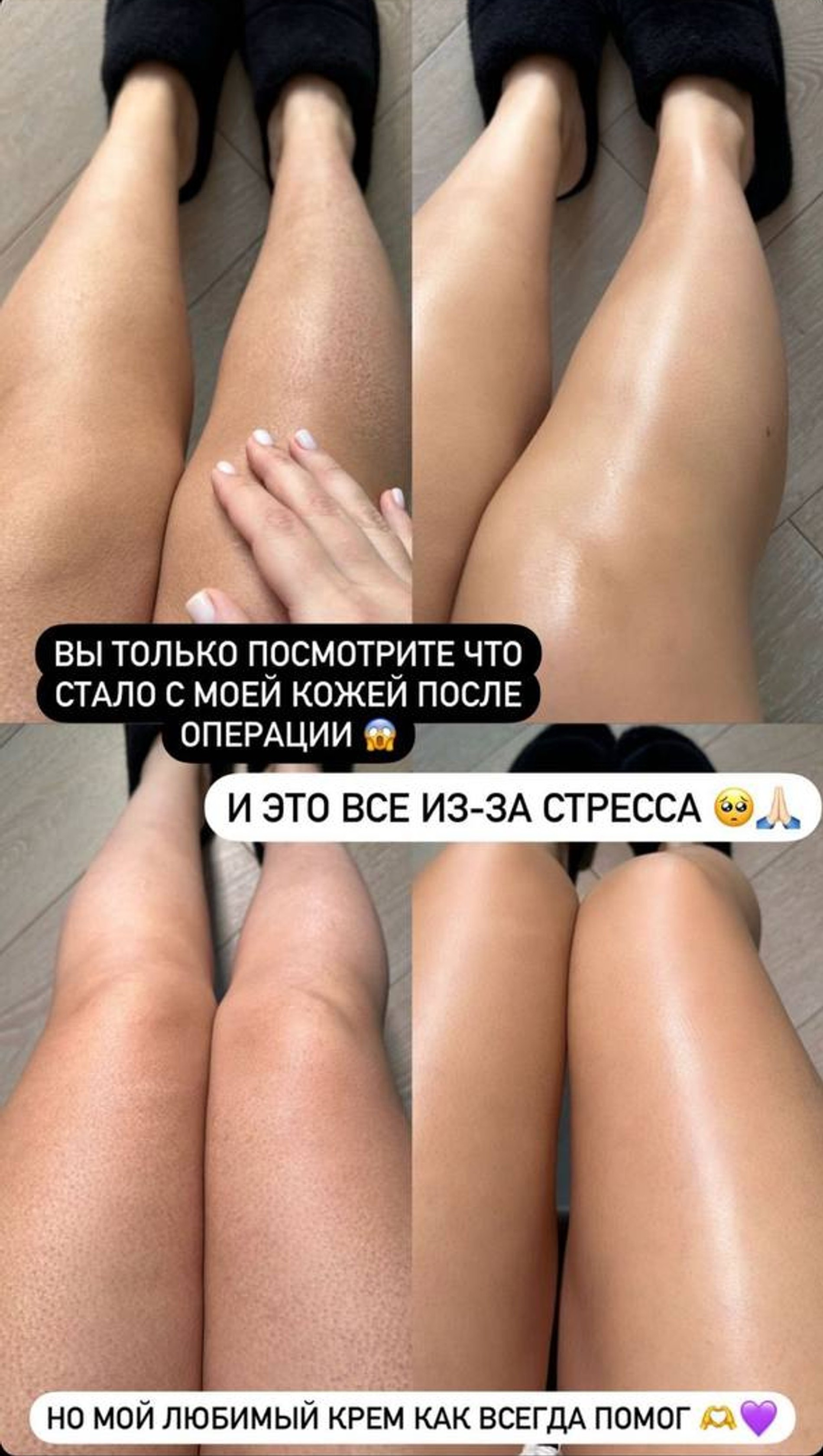 Гоар Аветисян
Фото: Инстаграм (запрещен в РФ) / @goar_avetisyan