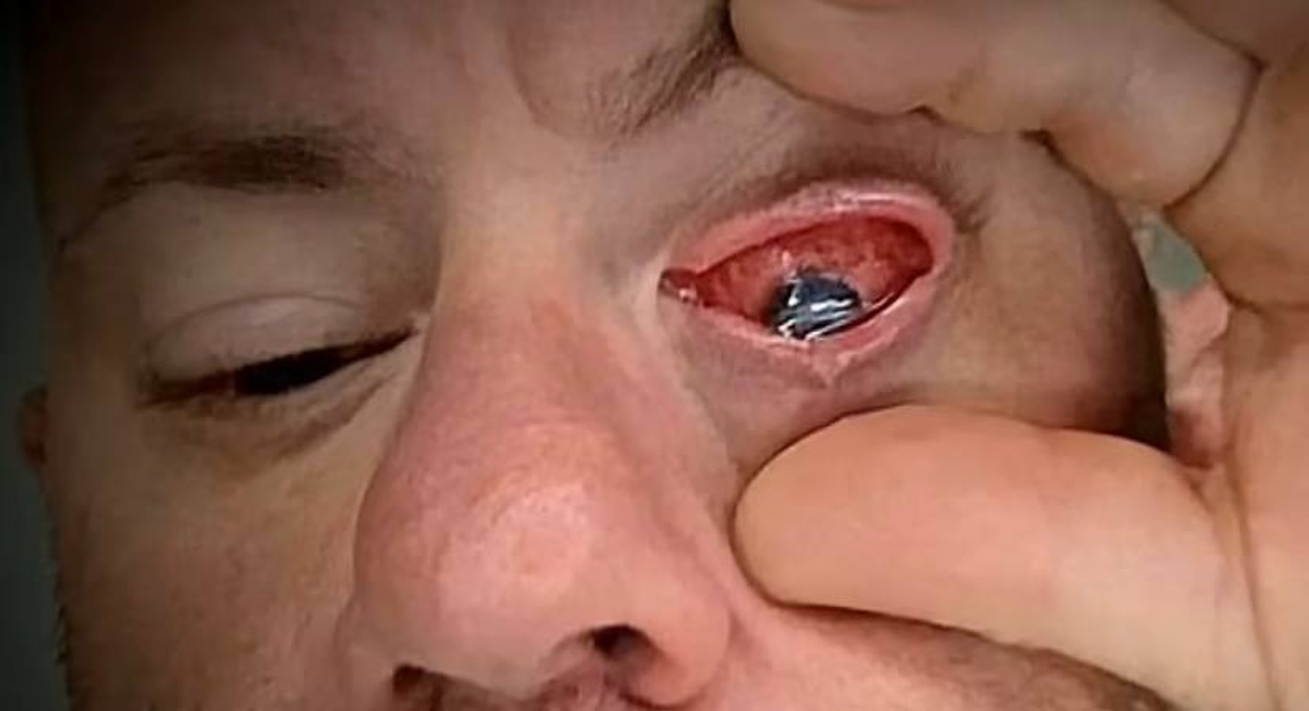 Адам Ди Сарро показал страшный результат использования капель
Фото: Daily Mail