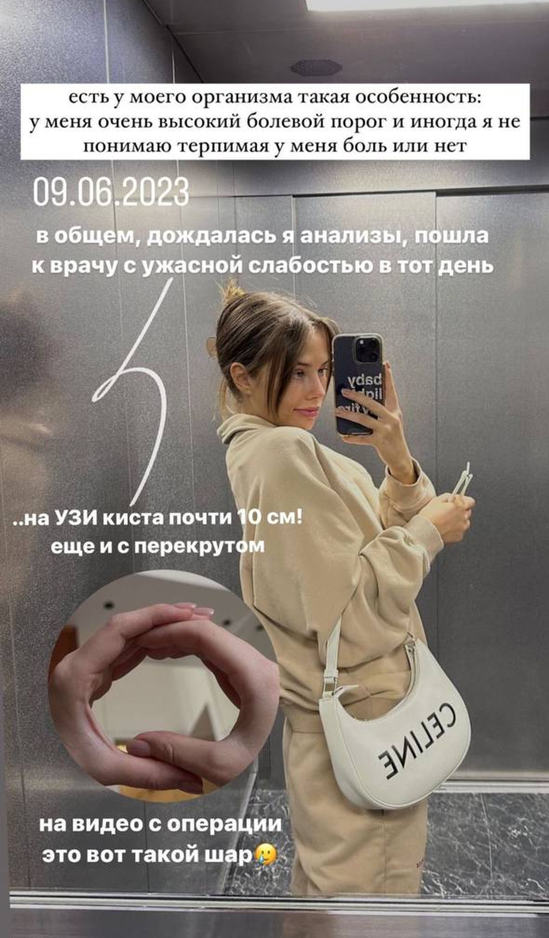 Фото: Инстаграм (запрещен в РФ) / @lianashulginaa
