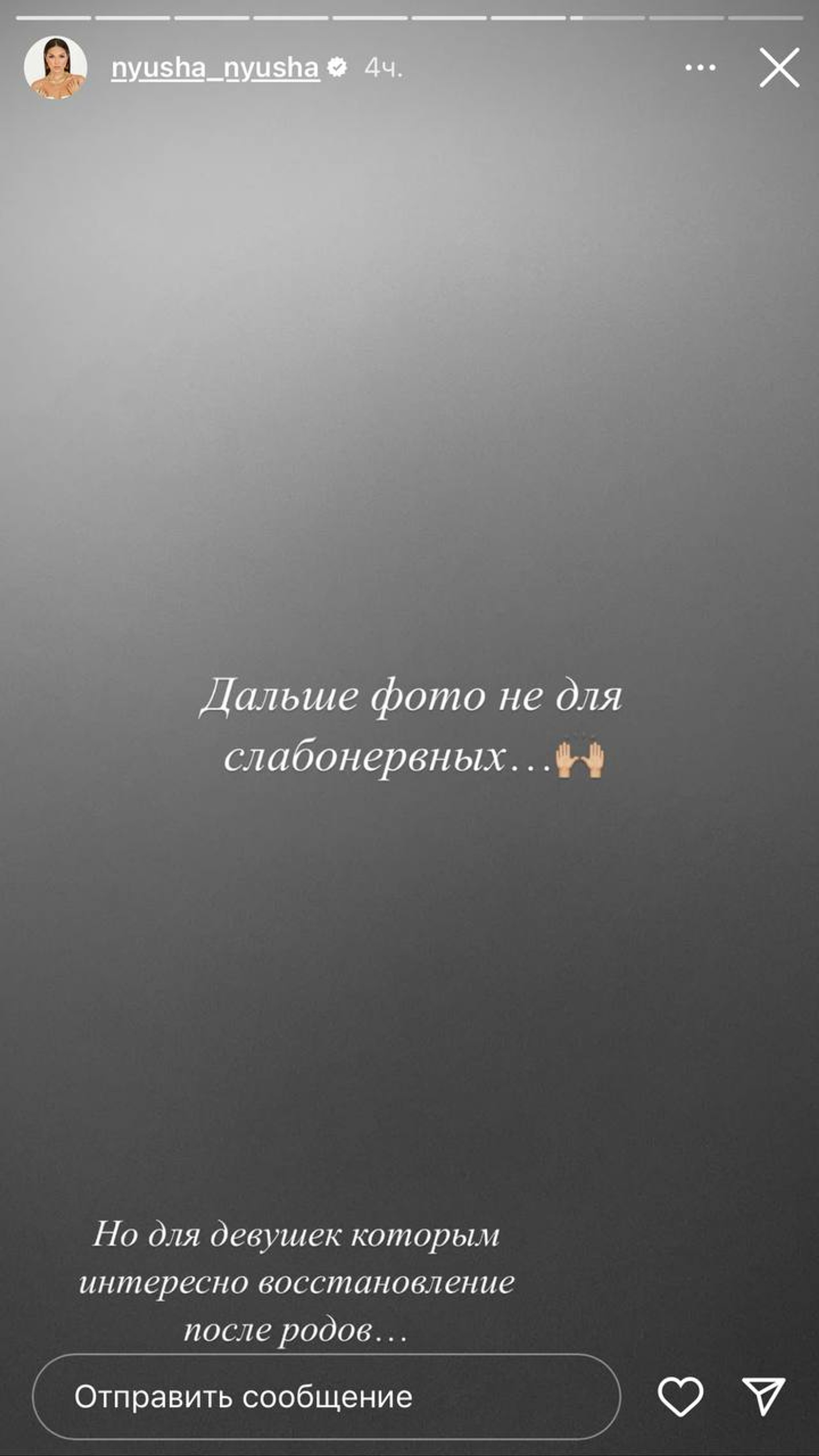 Фото: Инстаграм* @nyusha_nyusha