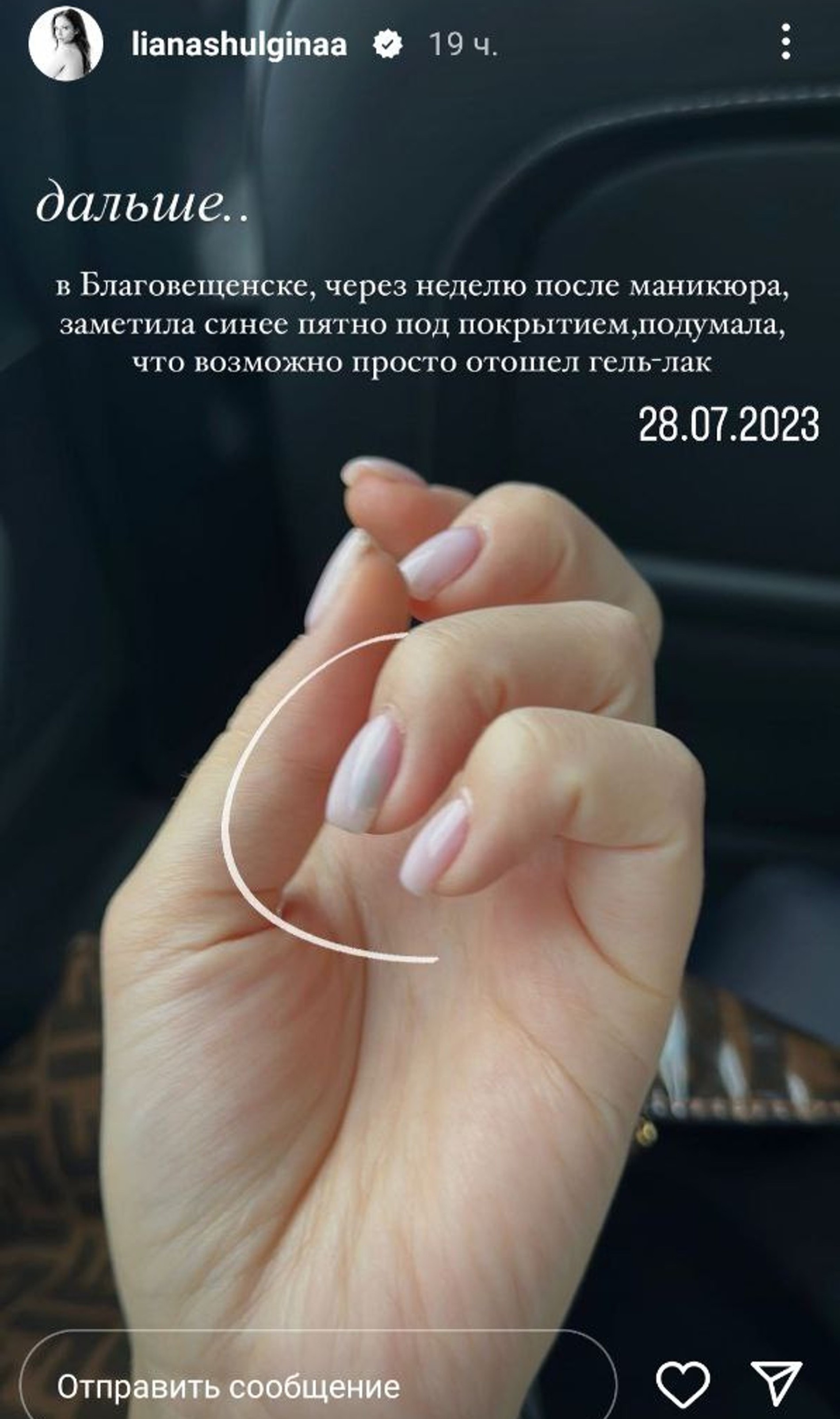 Фото: Инстаграм (запрещен в РФ) Лианы Шульгиной