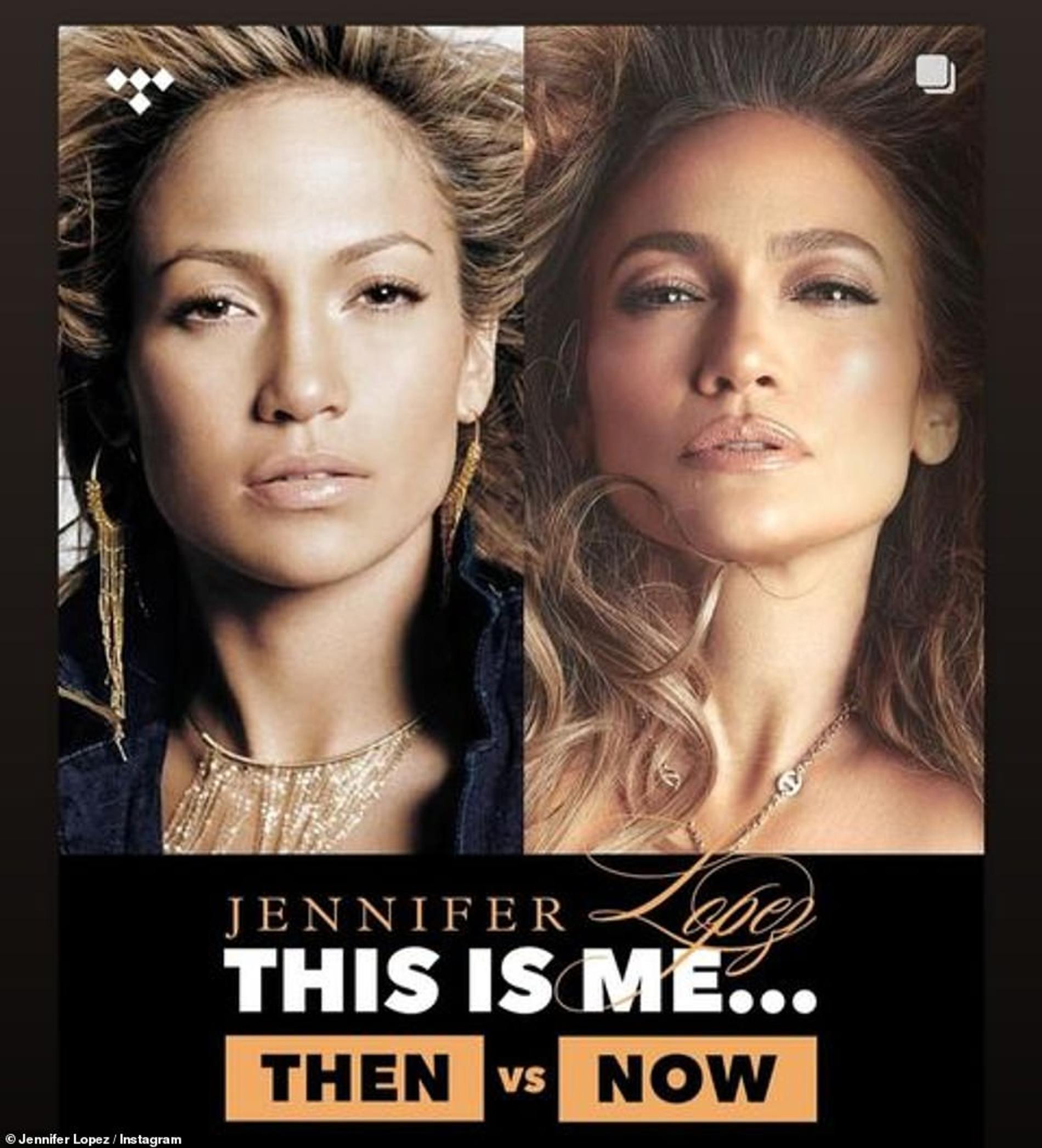 Дженнифер Лопес в 2004 и в 2024 году. Фото: Инстаграм* jlo
