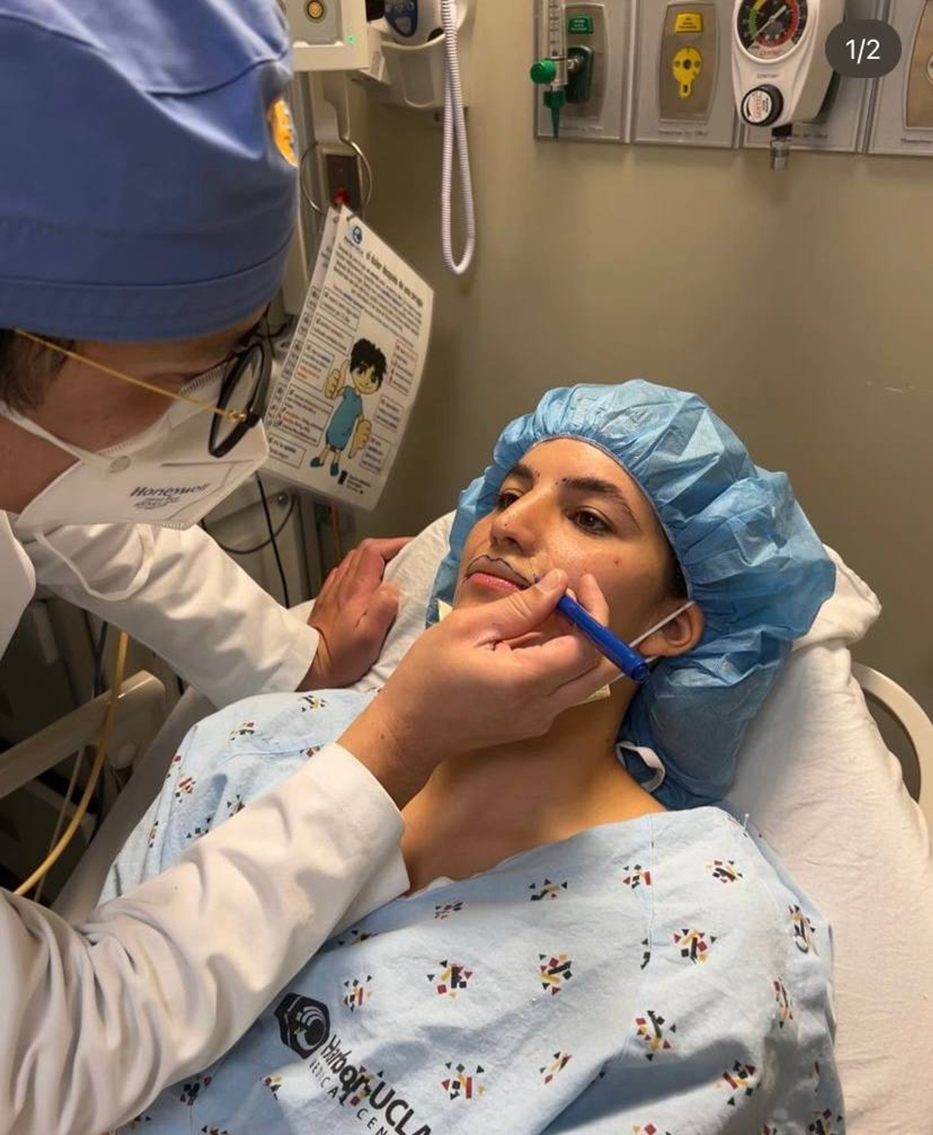 Хирург рисует верхнюю губу на лице Бруклинн перед финальной операцией
Фото: Инстаграм (запрещен в РФ) @brookhoury
