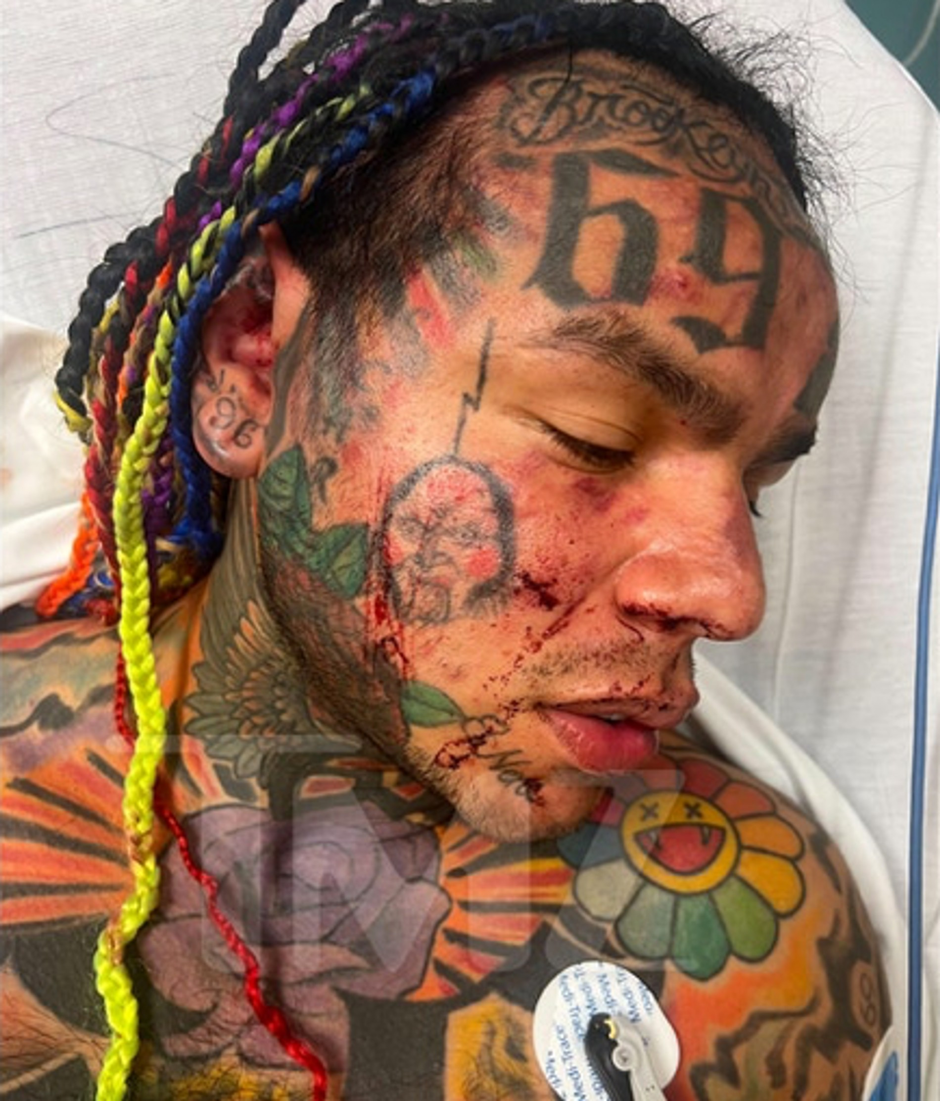 Рэпера Tekashi 6ix9ine избили до полусмерти в фитнес-клубе США