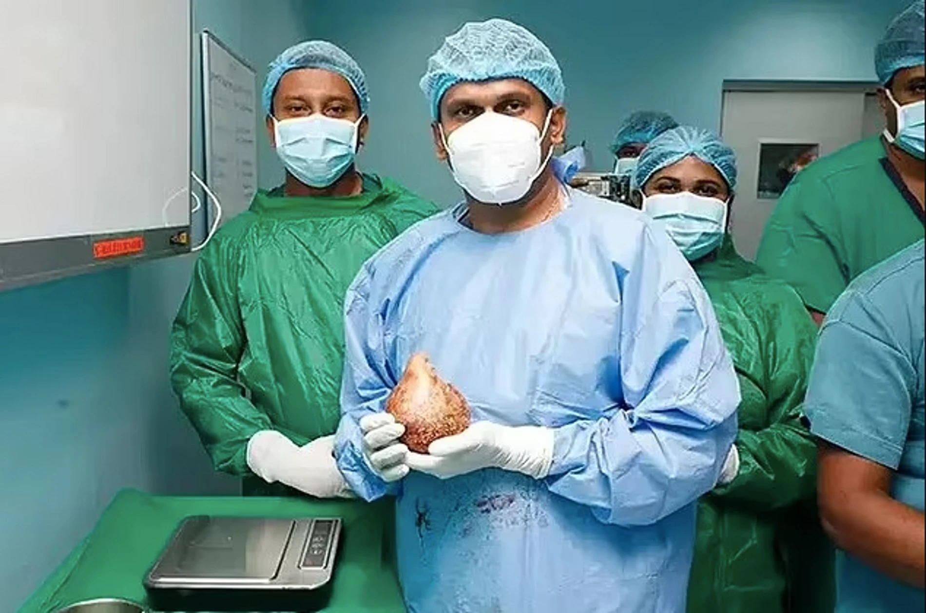 Команда хирургов, удаливших камень
Фото: Daily Mail