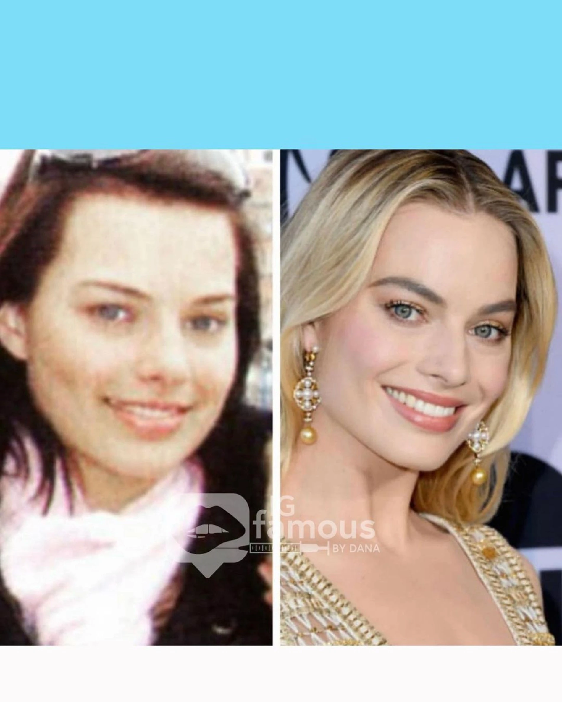 Марго Робби до и после изменений во внешности. Фото: Инстаграм* @igfamousbydana