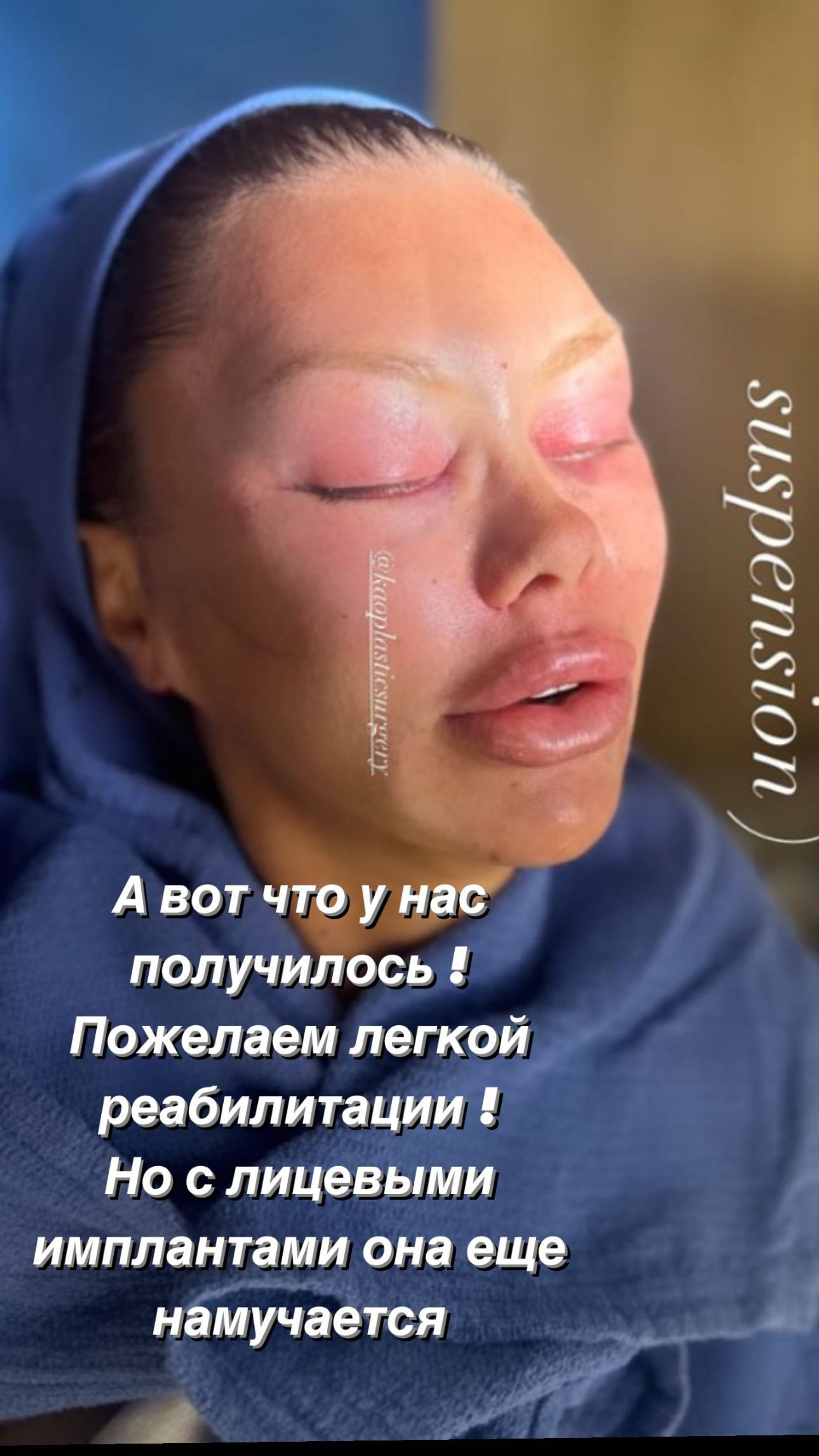 Сторис Аланы Мамаевой про Викторию Боню. Фото: Инстаграм* @alana_mamaeva2.0