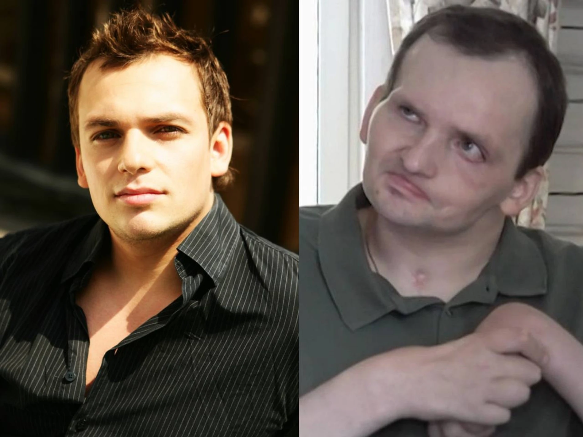 Алексей Янин до и после инсульта. Фото: соцсети