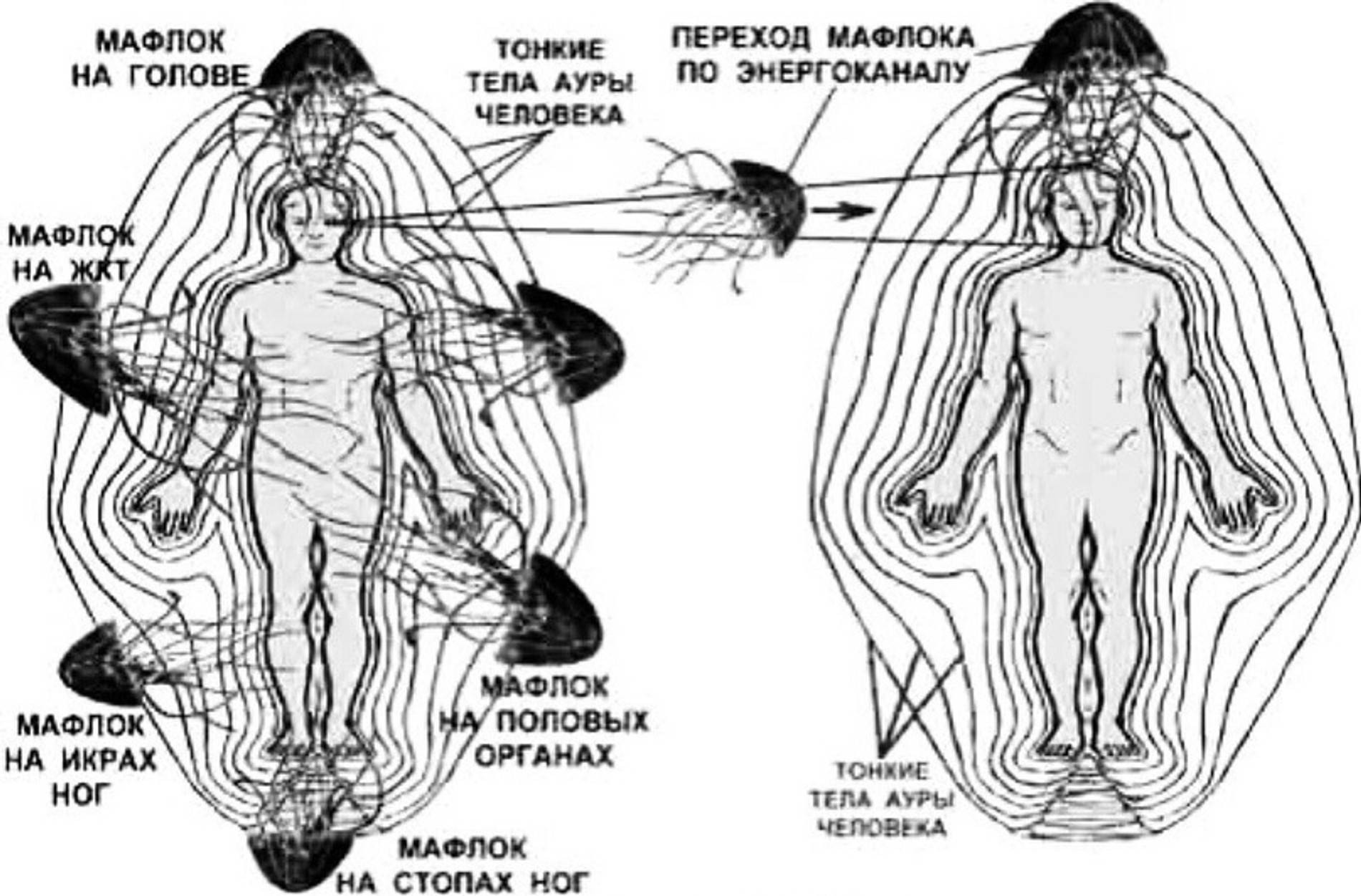 Схема путей, по которым мафлоки попадают в ауру человека. Источник: соцсети