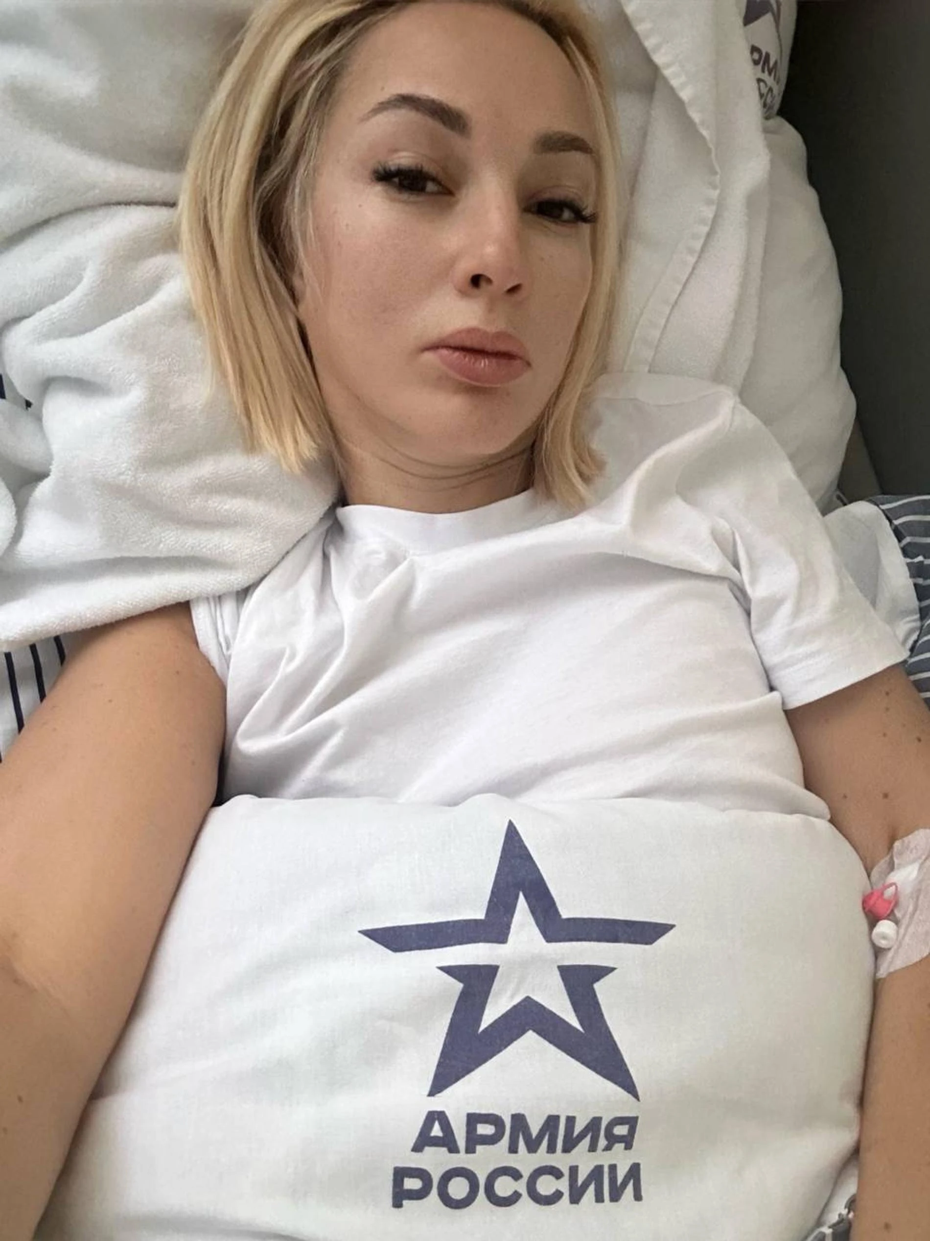 Лера Кудрявцева после операции. Фото: телеграм-канал @lerakudryavtseva