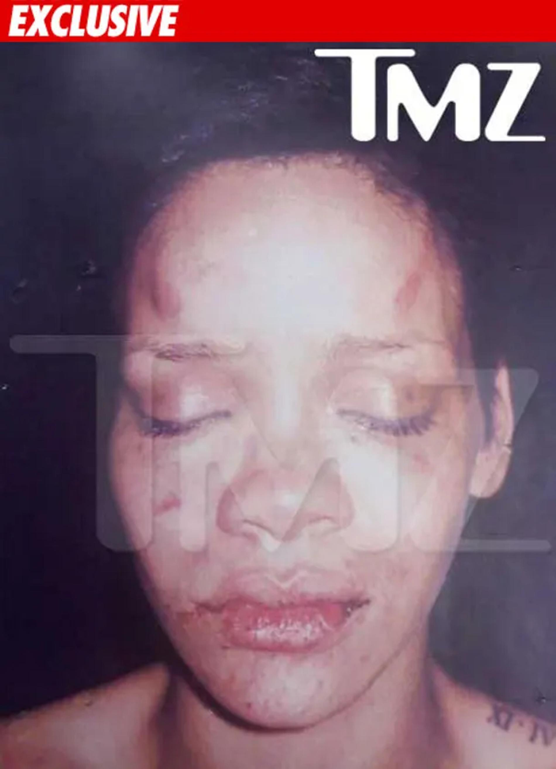 Рианна после избиения. Фото: TMZ