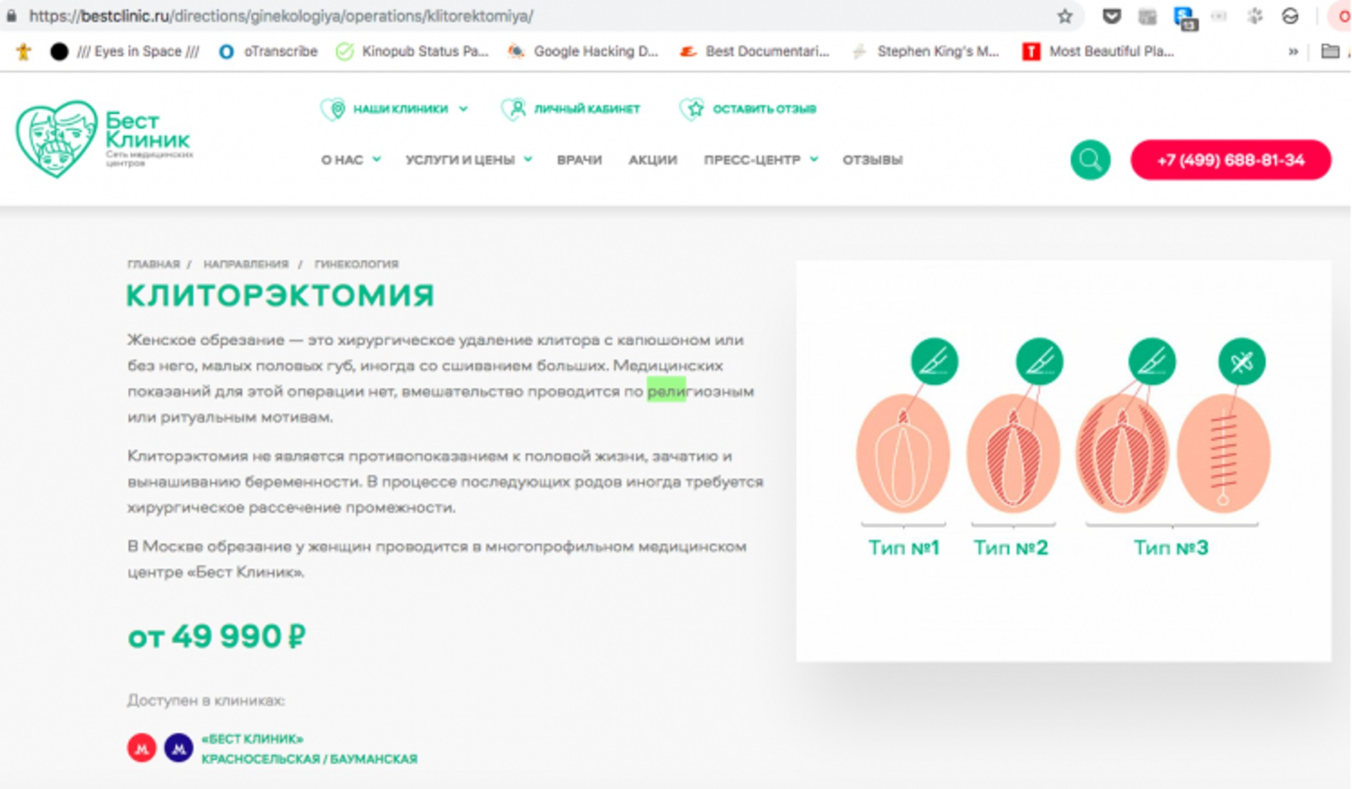 Сколько Стоит Обрезание В Москве