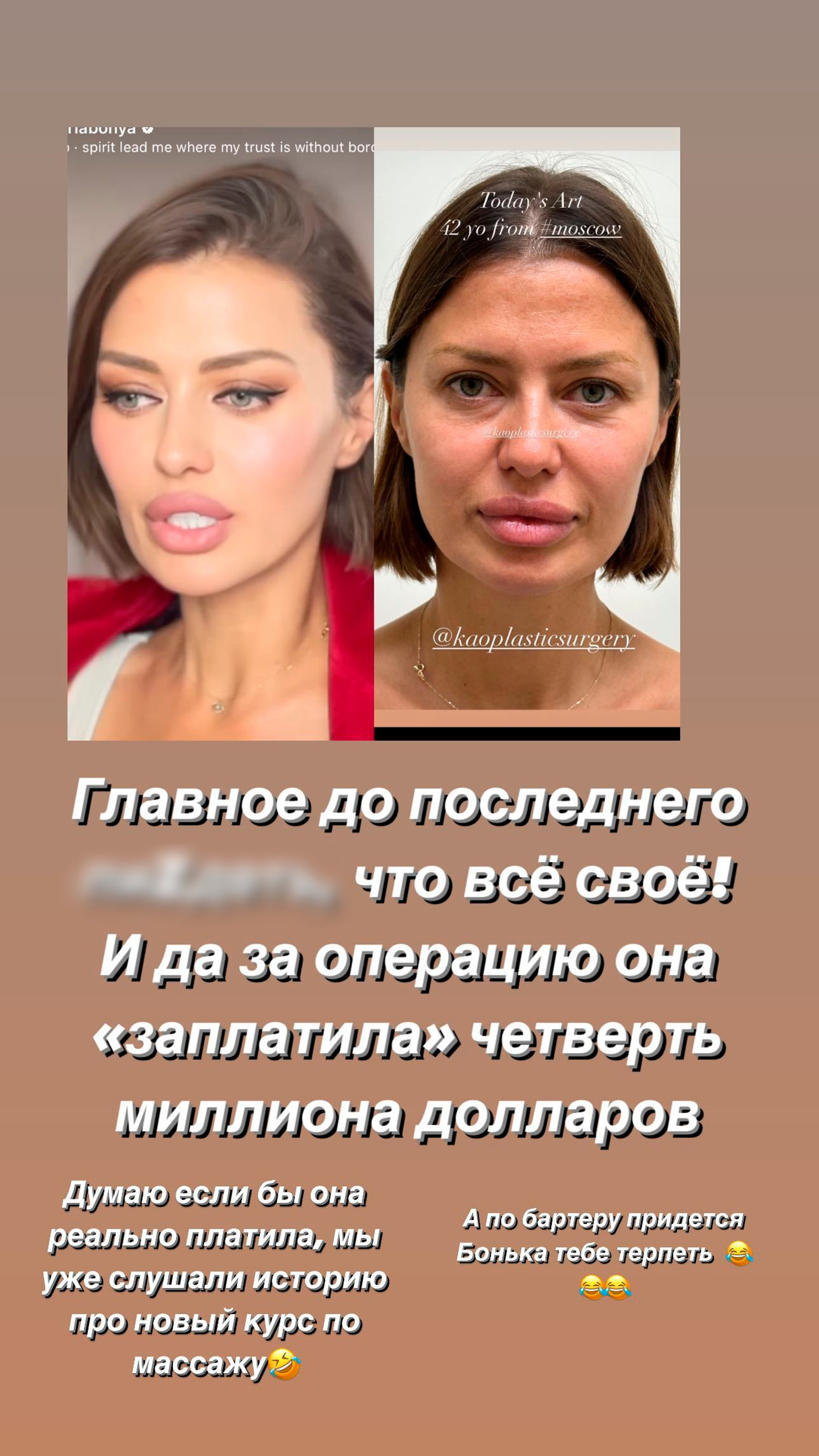 Алана Мамаева раскритиковала Викторию Боню за старые пластические ...