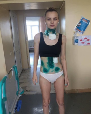 Ирина Веденяпина после нападения мужа. Источник: Инстаграм (запрещен в РФ) / irina_makeup_artist_