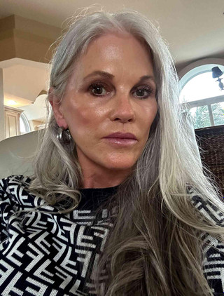 Через 6 месяцев после операции. Фото: People