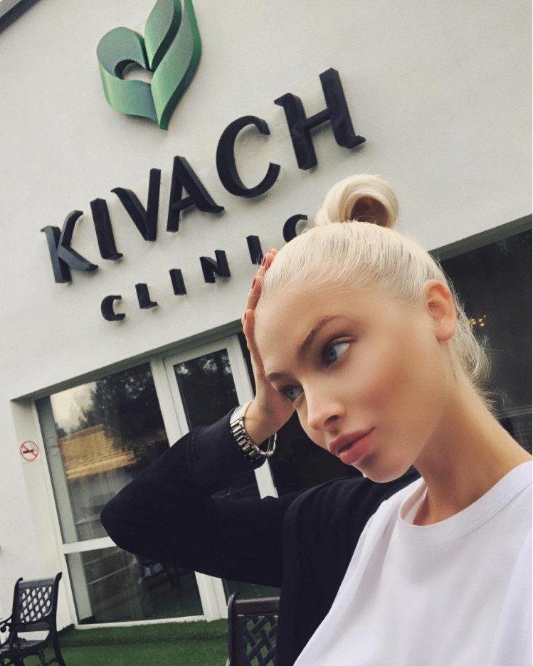 Алена Шишкова. Фото: Instagram