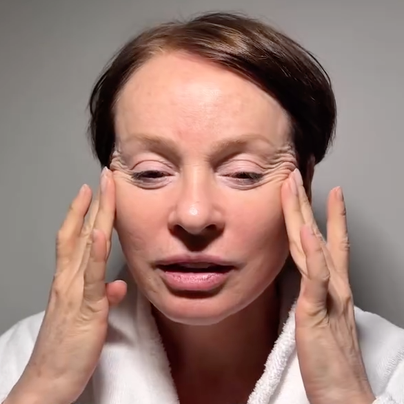 Жанна Эппле до пластической операции. Скриншот: Инстаграм (запрещён в РФ)