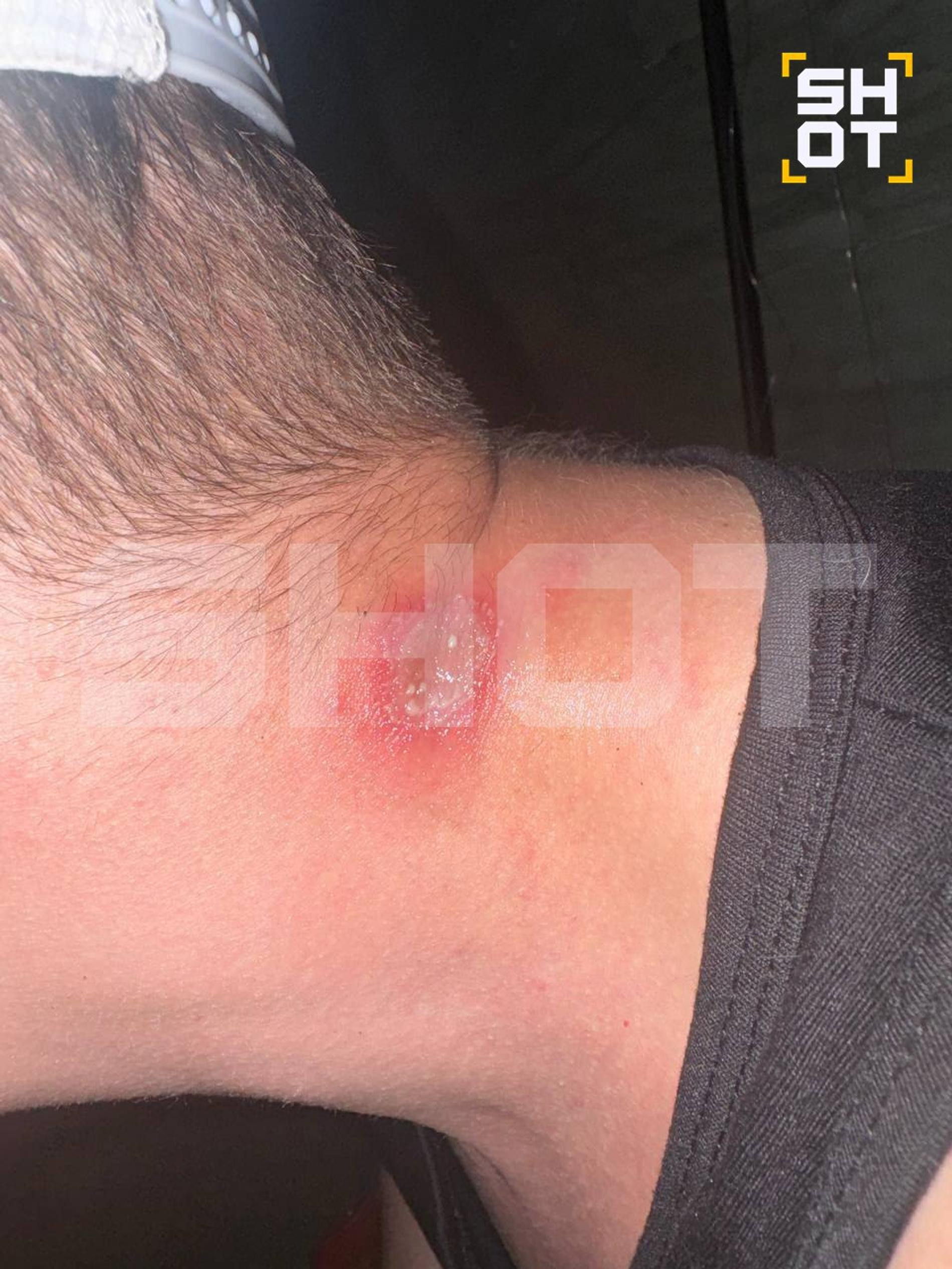 Фото: Telegram-канал Shot