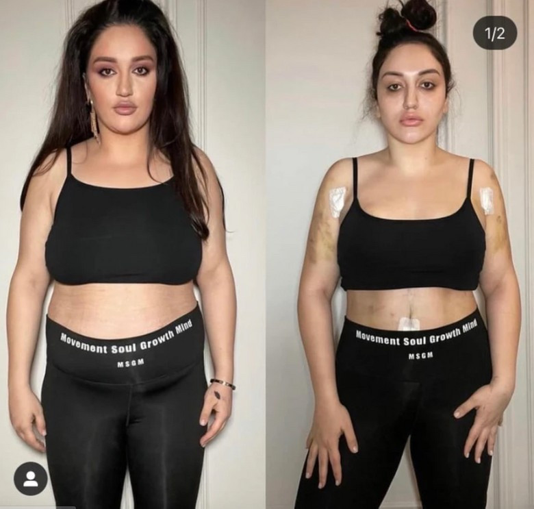 Фото: Инстаграм (запрещен в РФ) Гоар Аветисян