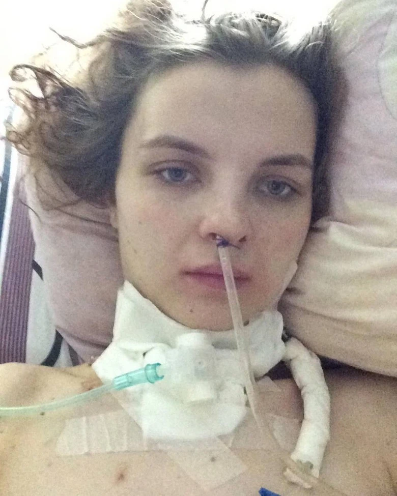 Ирина Веденяпина после нападения мужа. Источник: Инстаграм (запрещен в РФ) / irina_makeup_artist_