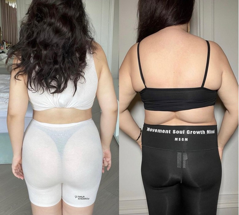 Гоар Аветисян. Фото: Инстаграм (запрещен в РФ) / @dr.timur_khidarov