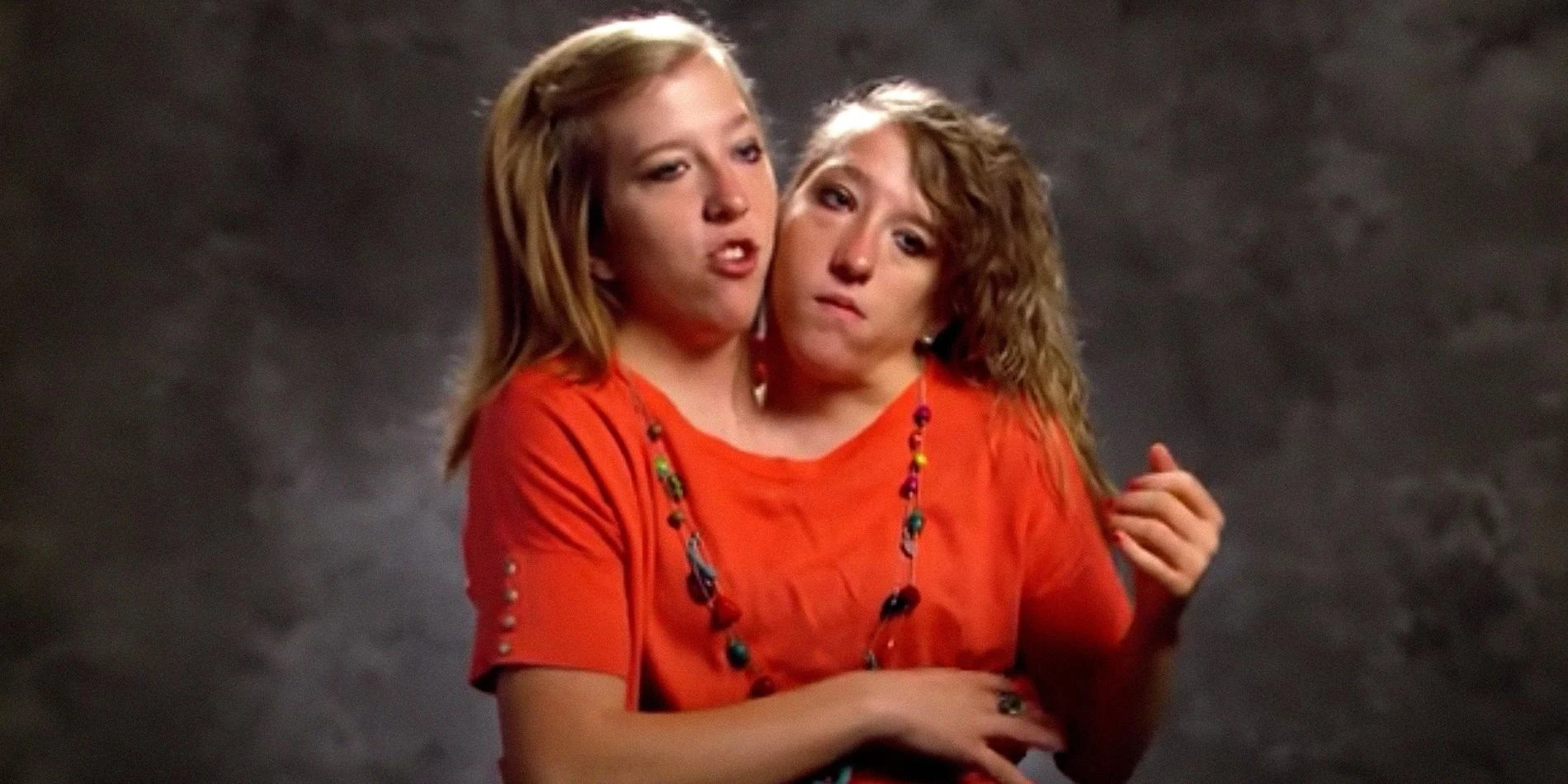 Эбигейл и Бриттани Хенсел. Фото: TLC