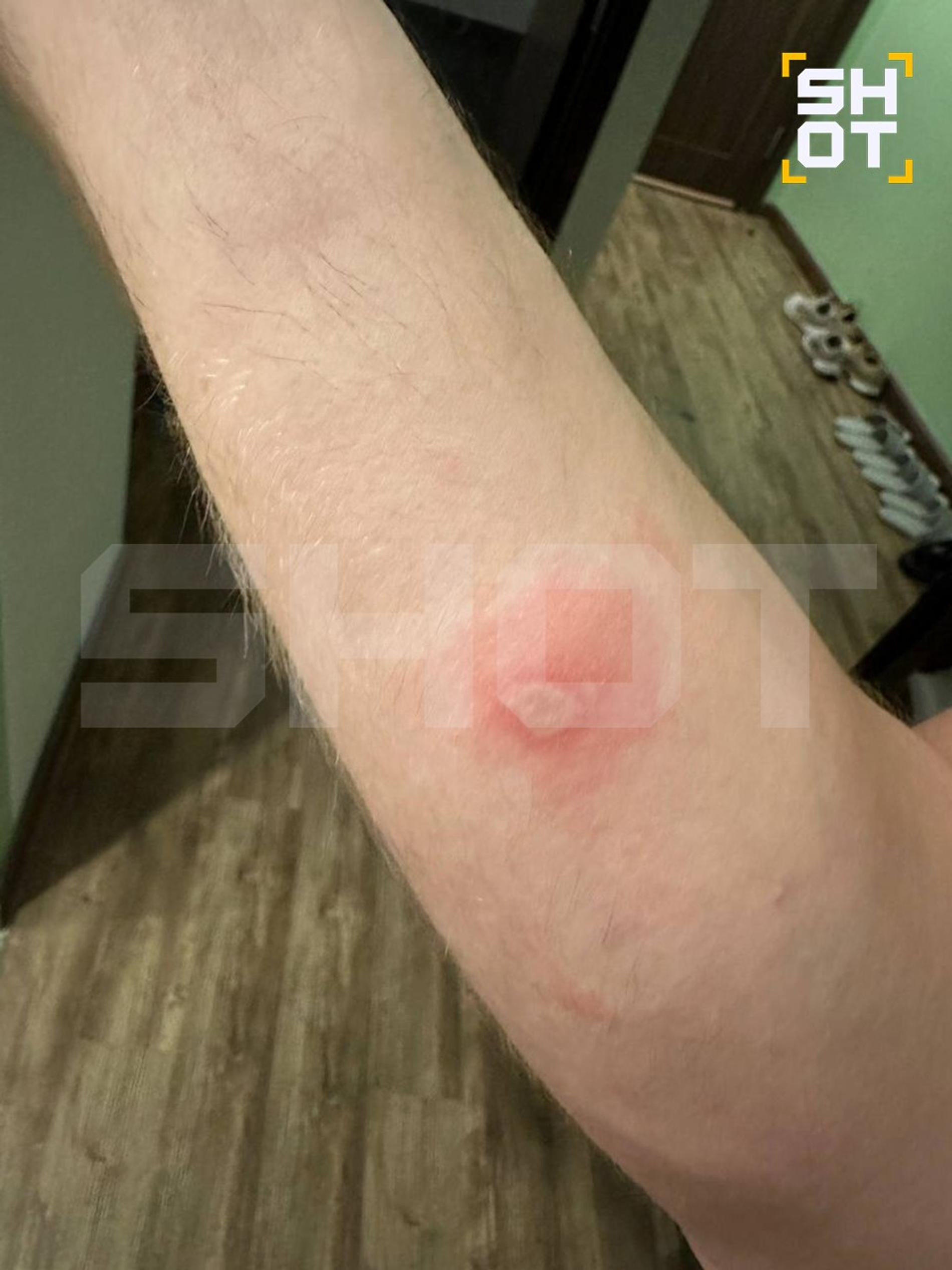 Фото: Telegram-канал Shot