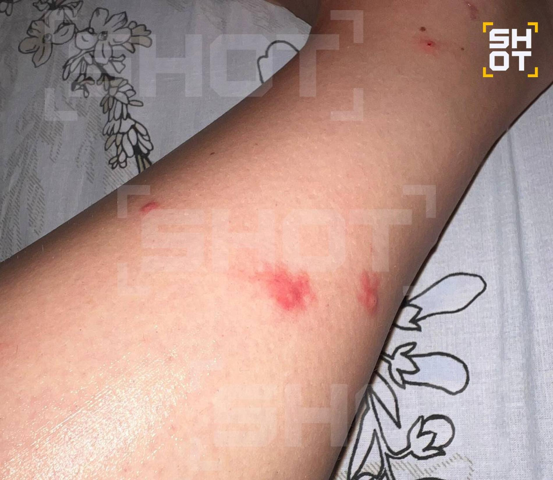 Фото: телеграм-канал Shot